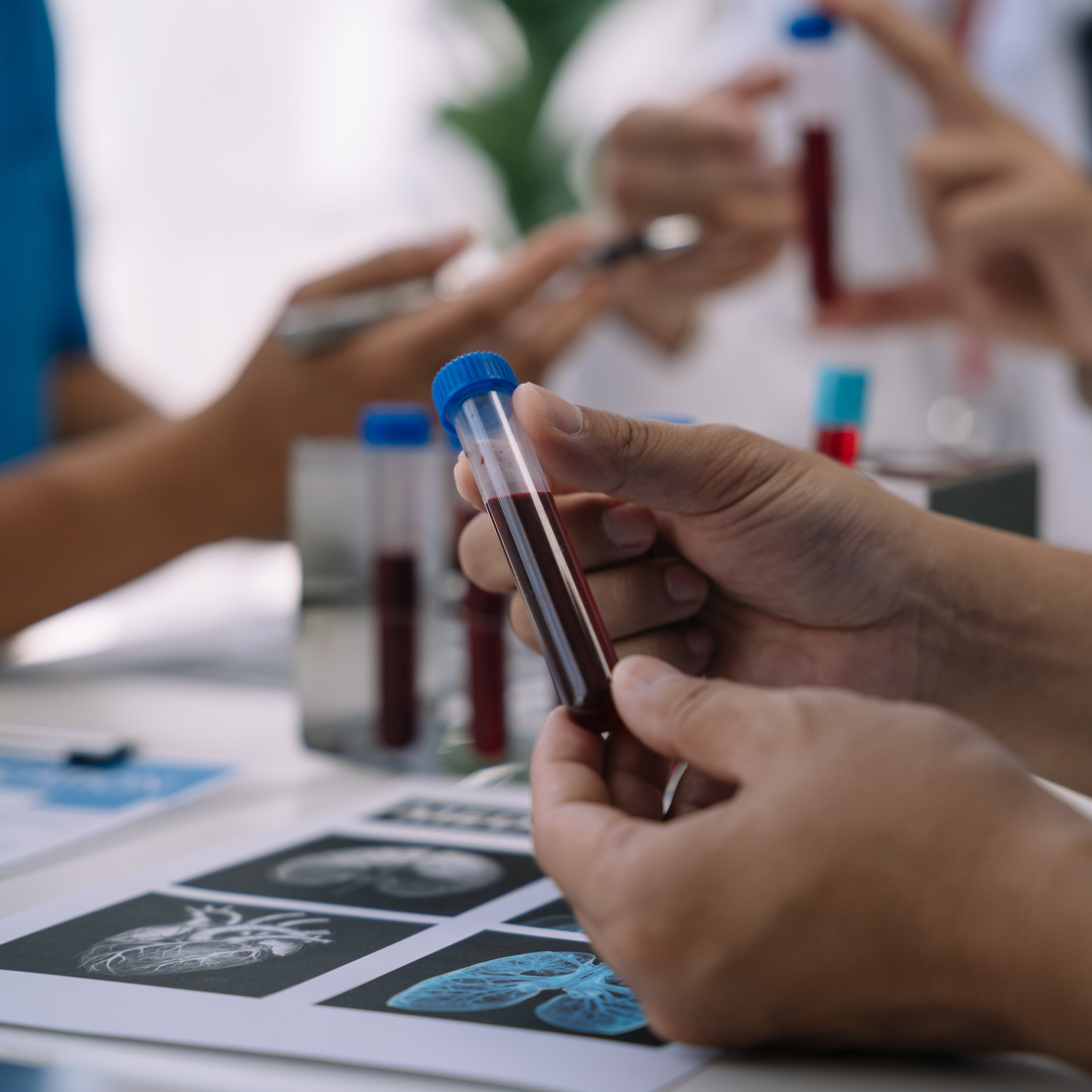 Leitfaden zur Interpretation von Schilddrüsen-Blutwerten: Mehr als 5 Minuten Aufmerksamkeit für deine Gesundheit
